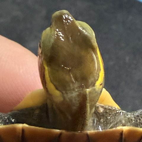 头纹