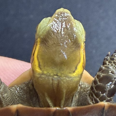 头纹