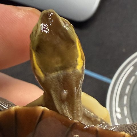 头纹