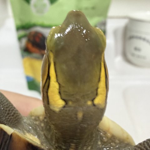 头纹